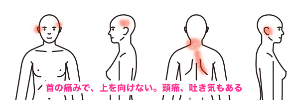 人体女首の症例2