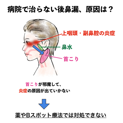 病院では治らない後鼻漏の原因