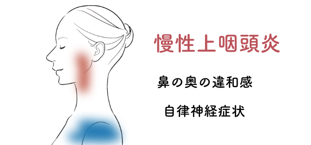 慢性上咽頭炎の名医症例004