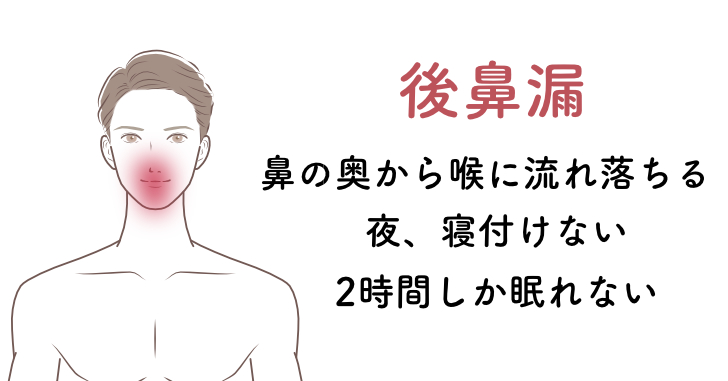 後鼻漏の名医症例003
