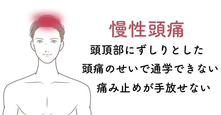十代の頭痛