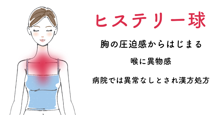 胸の圧迫感からはじまったヒステリー球