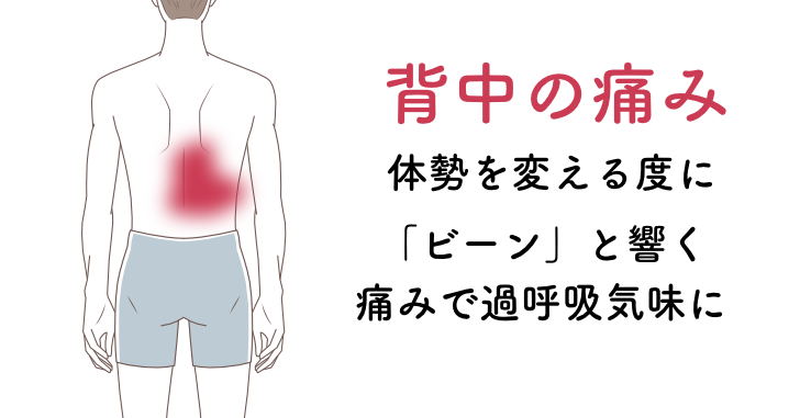 背中の痛みの症例。体勢を変える度にビーンとなる。