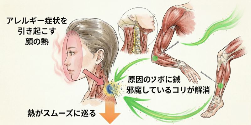 治療ポイント図解 - 手足のツボからうなじのコリを解消し熱の巡りを改善
