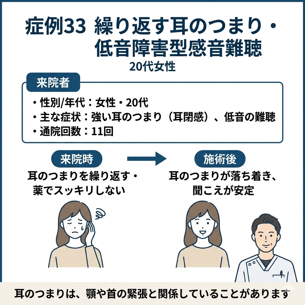 症例33 繰り返す耳のつまり（耳閉感）・低音障害型感音難聴 20代女性の鍼灸改善症例まとめ図