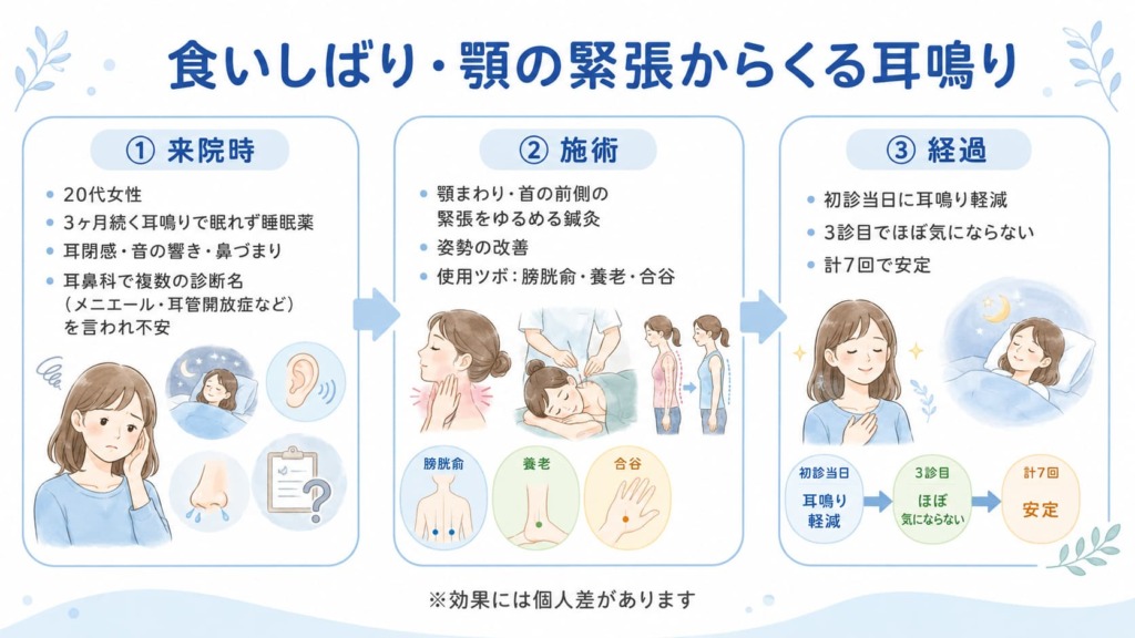 症例35 食いしばり・顎の緊張からくる眠れない耳鳴り 20代女性の鍼灸改善症例まとめ図